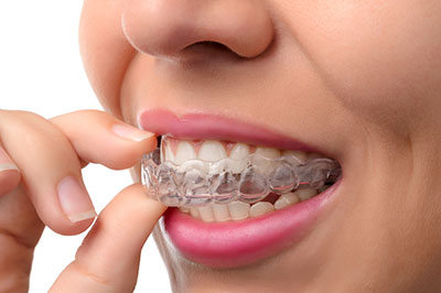 Invisalign Dentist 11772