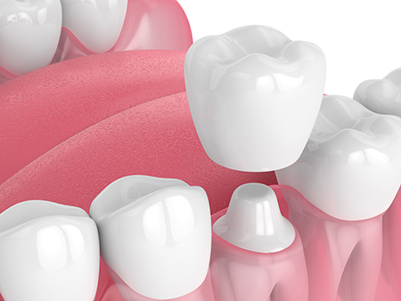 Sunset Dental Care